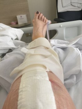knee in hospital